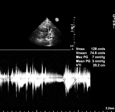 HIPAA secure transcription